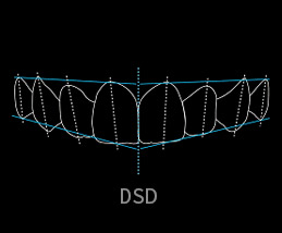 DSD數(shù)字美齒設(shè)計